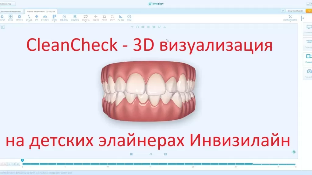 Программа 3D визуализации Инвизилайн - CleanCheck